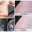 Unisex Blackhead Removal Mask & Nose Strips